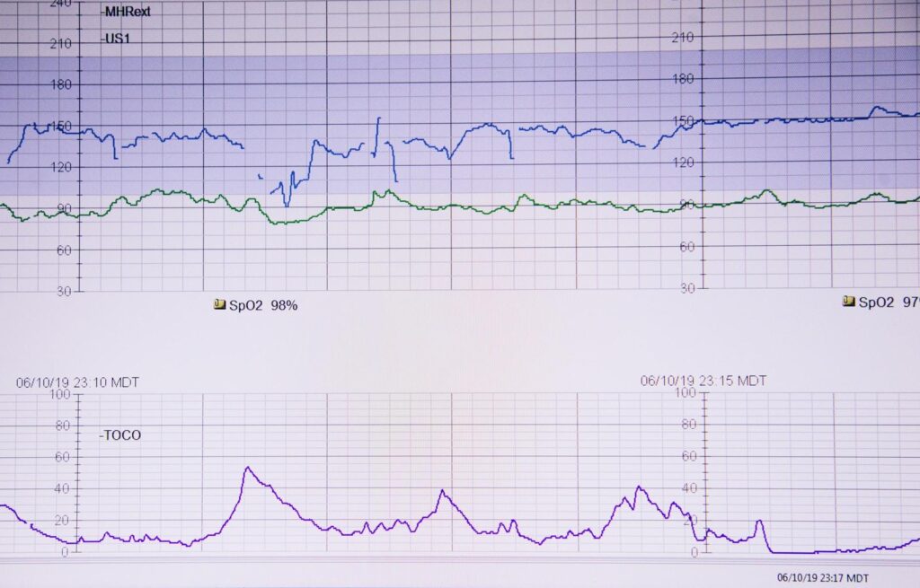 photo by sharon mccutcheon