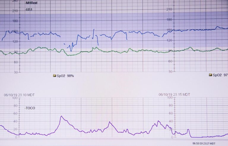 photo by sharon mccutcheon